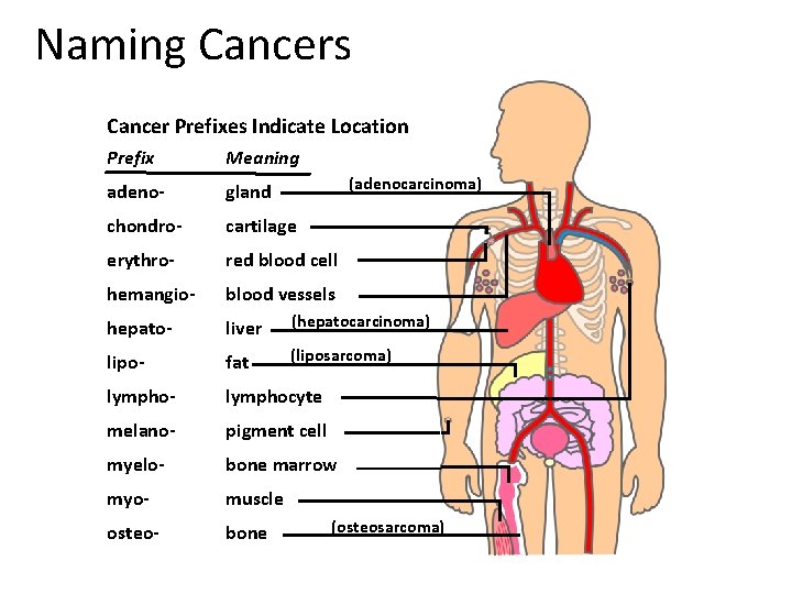Naming Cancers Cancer Prefixes Indicate Location Prefix Meaning adeno- gland chondro- cartilage erythro- red