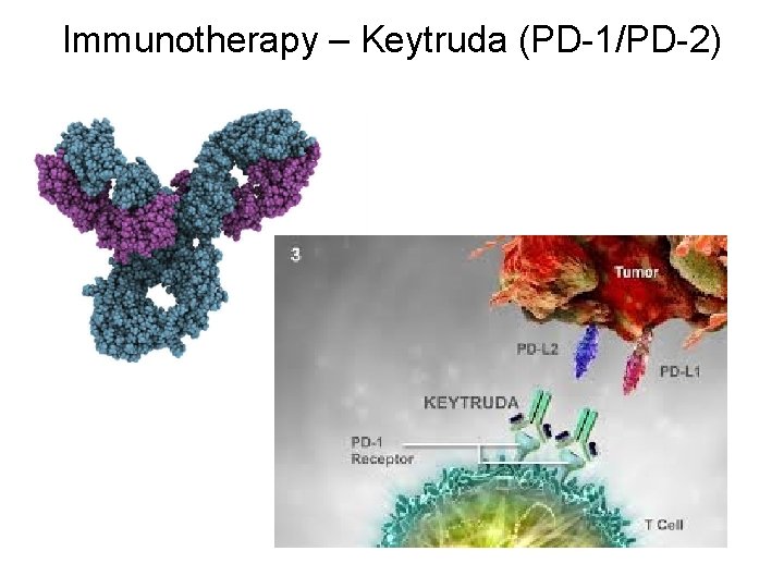 Immunotherapy – Keytruda (PD-1/PD-2) 