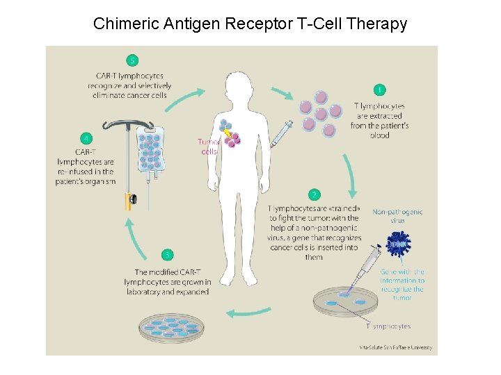 Chimeric Antigen Receptor T-Cell Therapy 