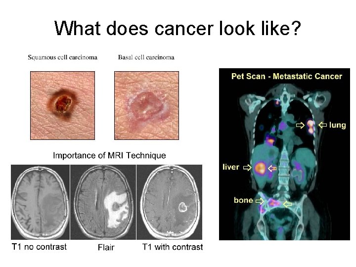 What does cancer look like? 