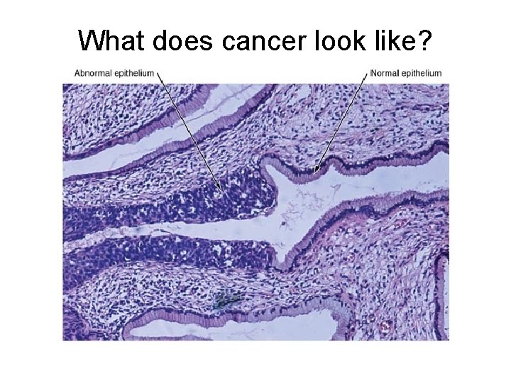 What does cancer look like? 