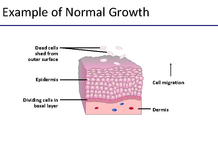 Example of Normal Growth Dead cells shed from outer surface Epidermis Dividing cells in