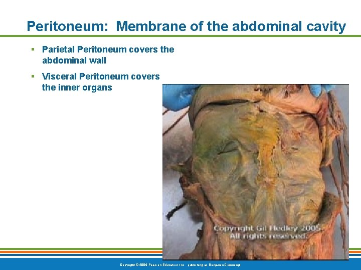 Peritoneum: Membrane of the abdominal cavity § Parietal Peritoneum covers the abdominal wall §