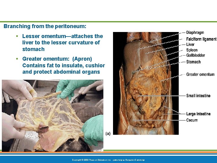 Branching from the peritoneum: § Lesser omentum—attaches the liver to the lesser curvature of