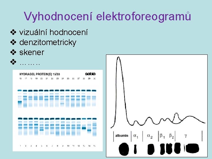 Vyhodnocení elektroforeogramů v vizuální hodnocení v denzitometricky v skener v ……. . 