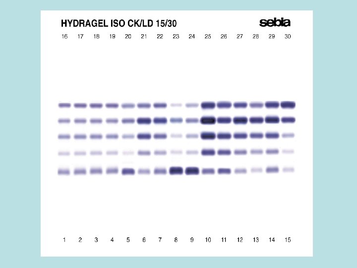 15 ISO LD 