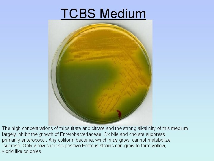 TCBS Medium The high concentrations of thiosulfate and citrate and the strong alkalinity of