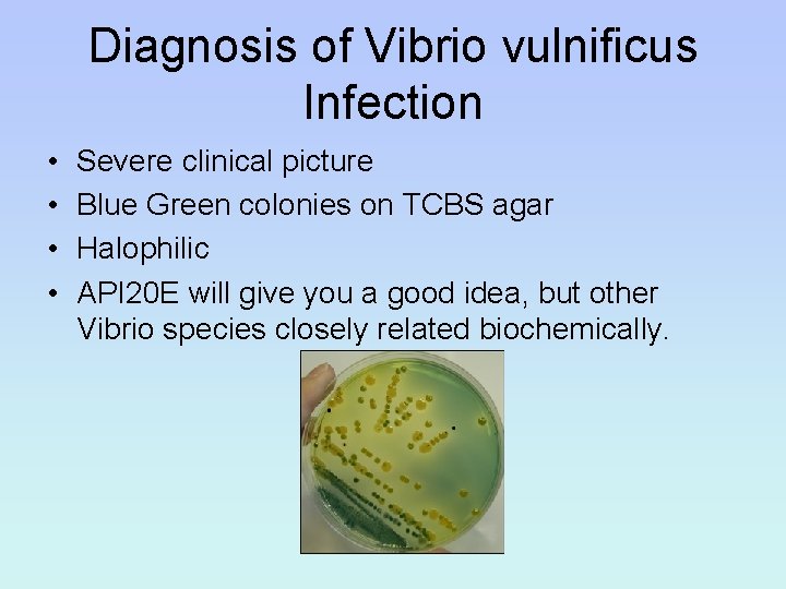 Diagnosis of Vibrio vulnificus Infection • • Severe clinical picture Blue Green colonies on