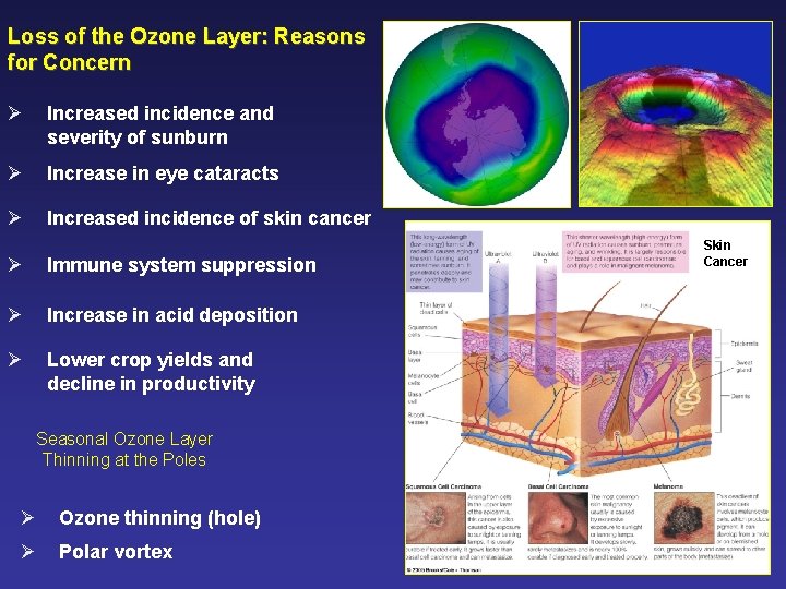 Loss of the Ozone Layer: Reasons for Concern Ø Increased incidence and severity of