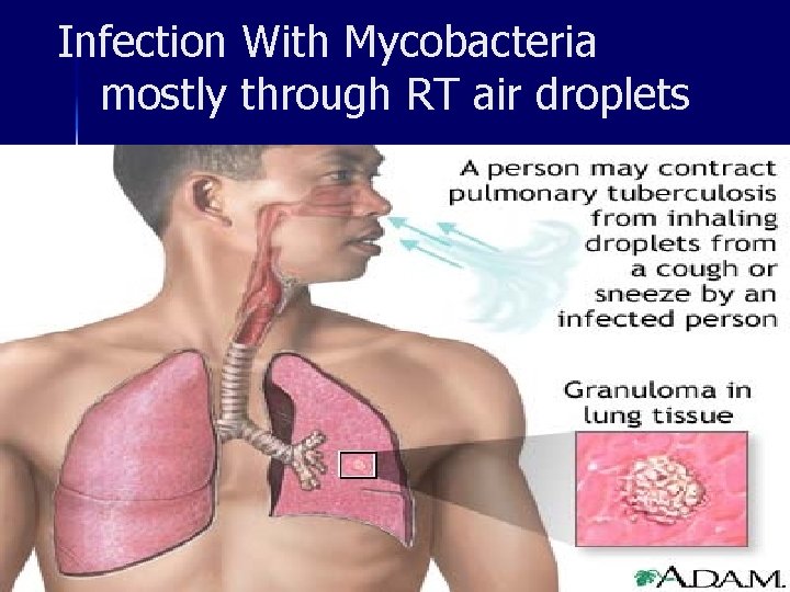 Infection With Mycobacteria mostly through RT air droplets 