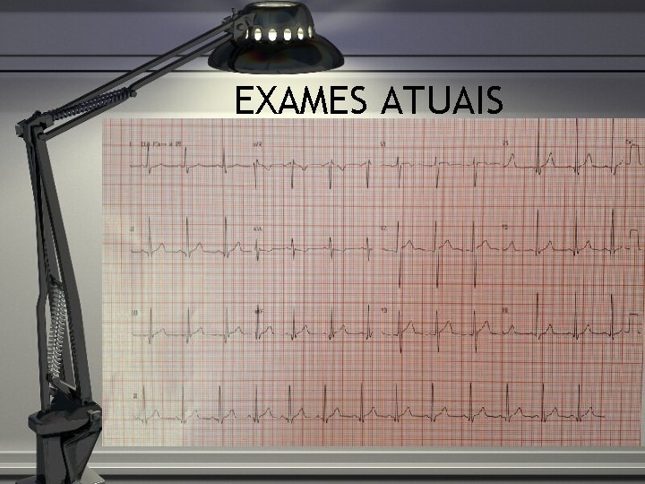 EXAMES ATUAIS 