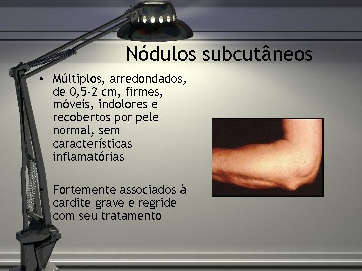 Nódulos subcutâneos • Múltiplos, arredondados, de 0, 5 -2 cm, firmes, móveis, indolores e