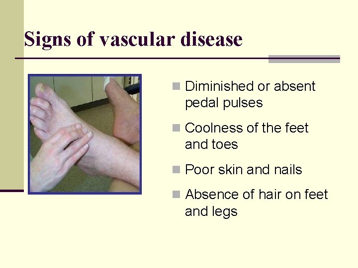 Signs of vascular disease n Diminished or absent pedal pulses n Coolness of the