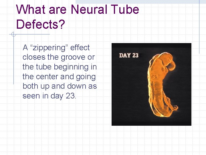 What are Neural Tube Defects? A “zippering” effect closes the groove or the tube