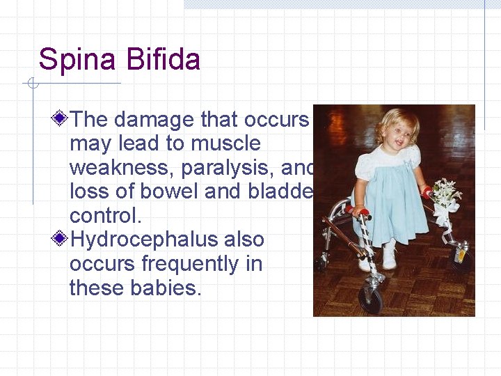 Spina Bifida The damage that occurs may lead to muscle weakness, paralysis, and loss