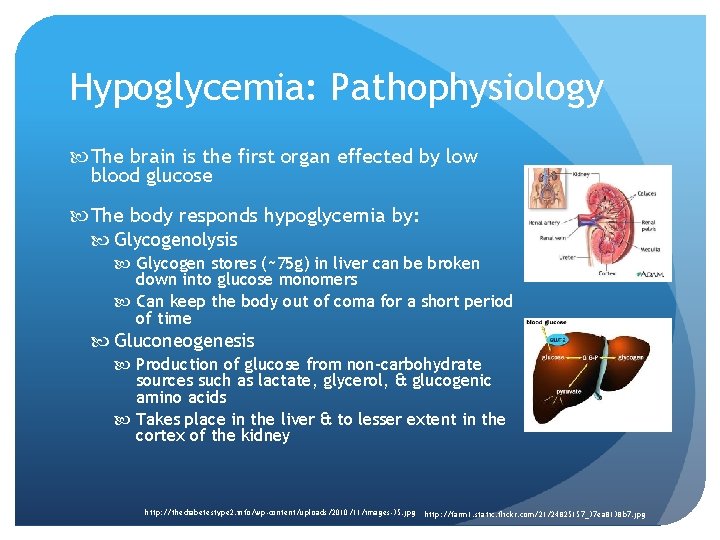 Hypoglycemia: Pathophysiology The brain is the first organ effected by low blood glucose The