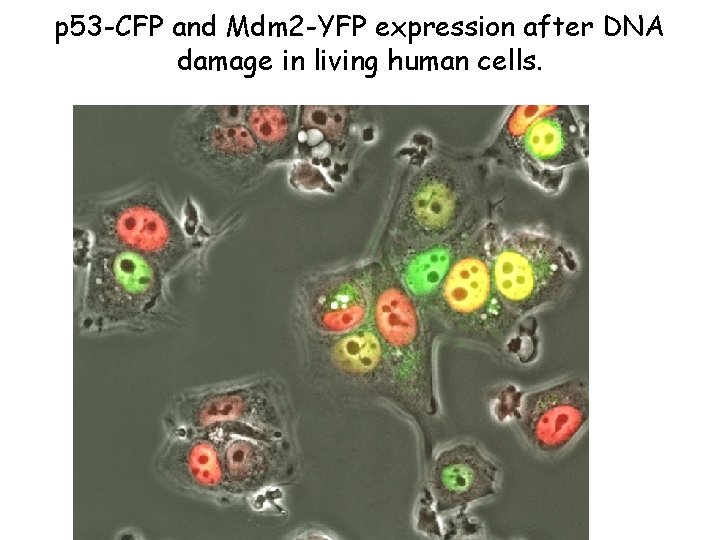 p 53 -CFP and Mdm 2 -YFP expression after DNA damage in living human