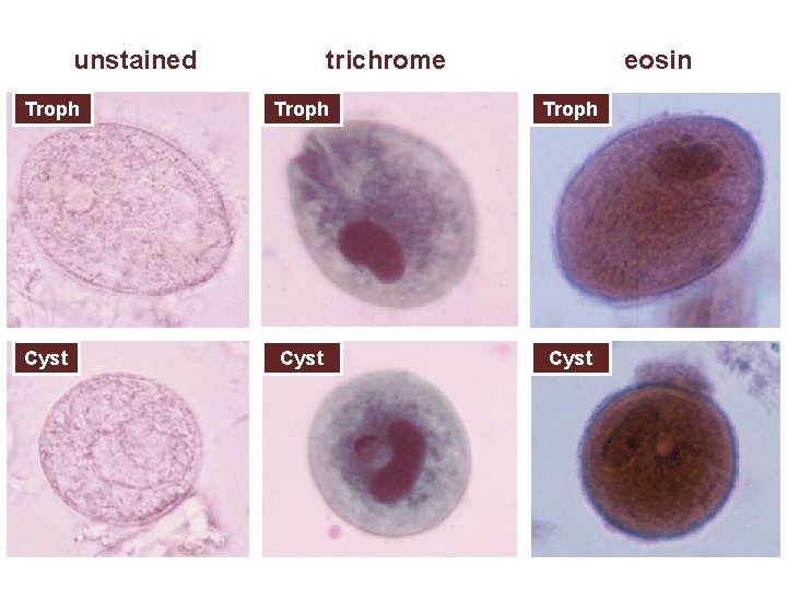 unstained Troph Cyst trichrome eosin Troph Cyst 
