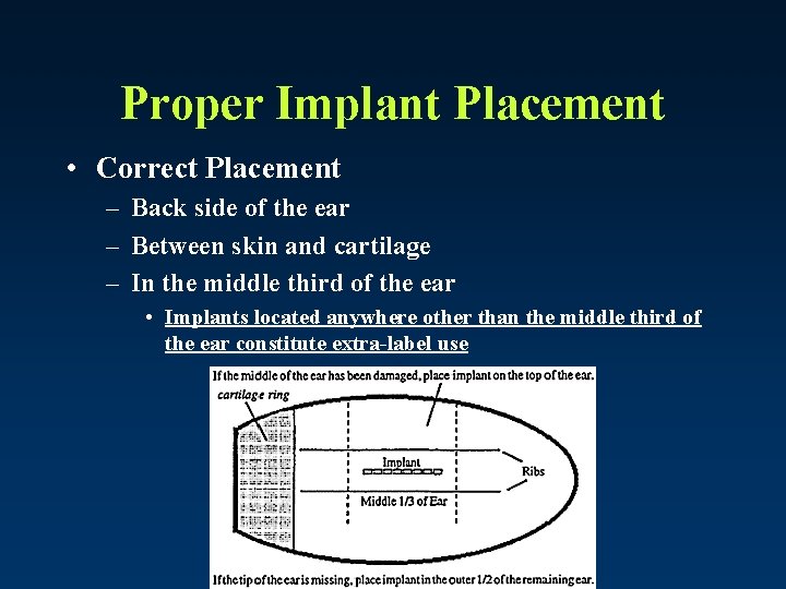 Proper Implant Placement • Correct Placement – Back side of the ear – Between