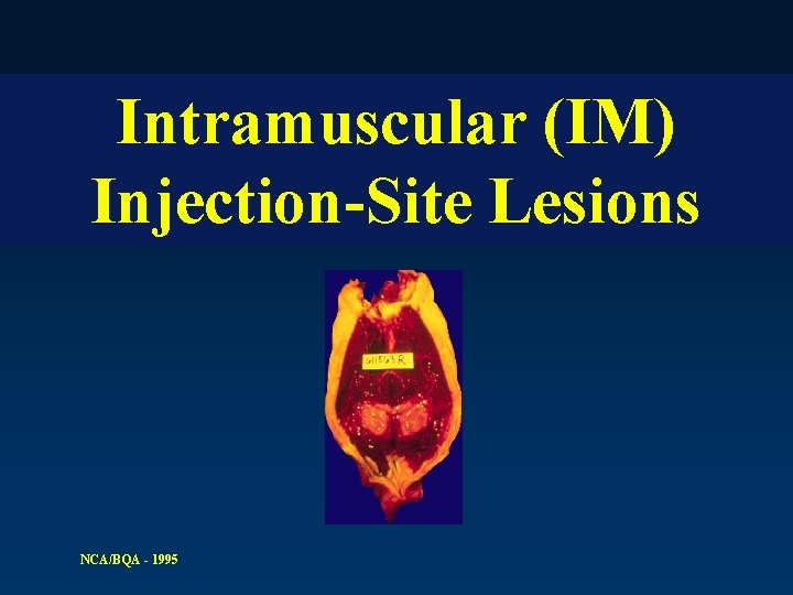Intramuscular (IM) Injection-Site Lesions NCA/BQA - 1995 
