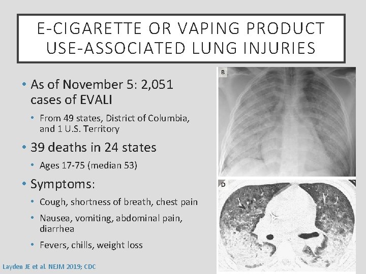 E-CIGARETTE OR VAPING PRODUCT USE-ASSOCIATED LUNG INJURIES • As of November 5: 2, 051