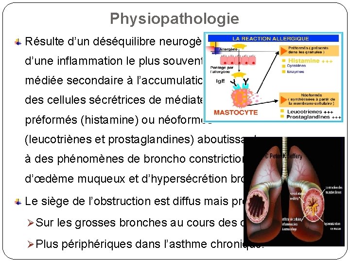 Physiopathologie Résulte d’un déséquilibre neurogène et d’une inflammation le plus souvent Ig. E médiée