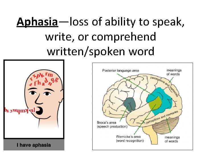 Aphasia—loss of ability to speak, write, or comprehend written/spoken word 