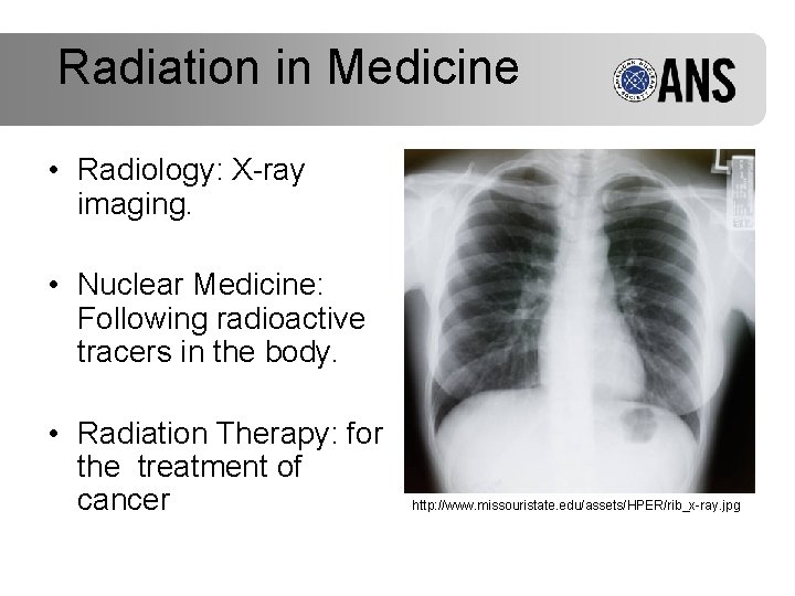 Radiation in Medicine • Radiology: X-ray imaging. • Nuclear Medicine: Following radioactive tracers in