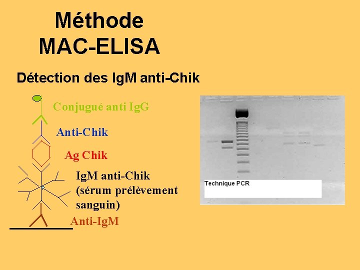 Méthode MAC-ELISA Détection des Ig. M anti-Chik Conjugué anti Ig. G Anti-Chik Ag Chik