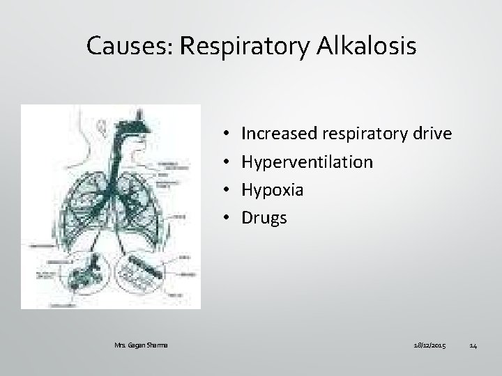 Causes: Respiratory Alkalosis • • Mrs. Gagan Sharma Increased respiratory drive Hyperventilation Hypoxia Drugs