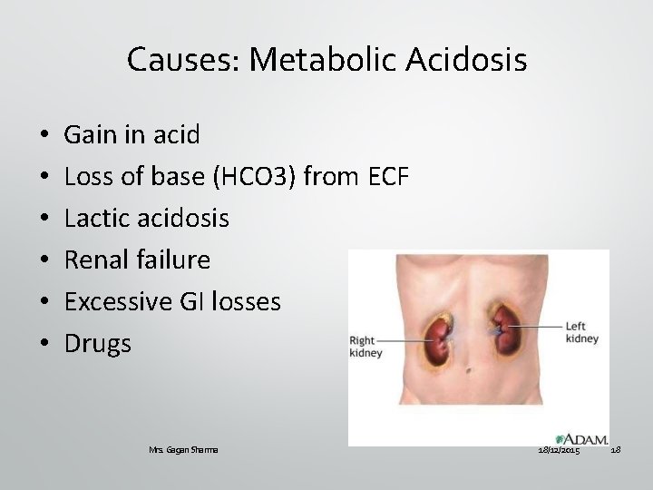 Causes: Metabolic Acidosis • • • Gain in acid Loss of base (HCO 3)