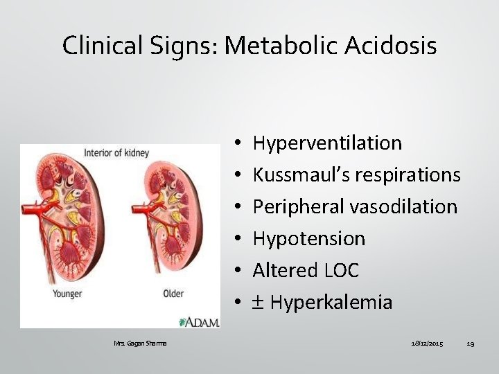 Clinical Signs: Metabolic Acidosis • • • Mrs. Gagan Sharma Hyperventilation Kussmaul’s respirations Peripheral