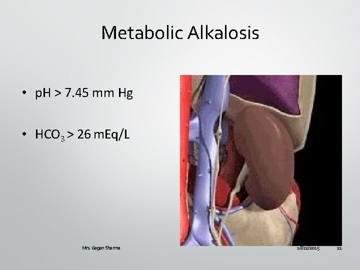 Metabolic Alkalosis • p. H > 7. 45 mm Hg • HCO 3 >