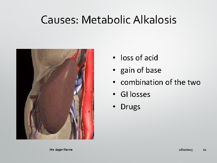 Causes: Metabolic Alkalosis • • • Mrs. Gagan Sharma loss of acid gain of