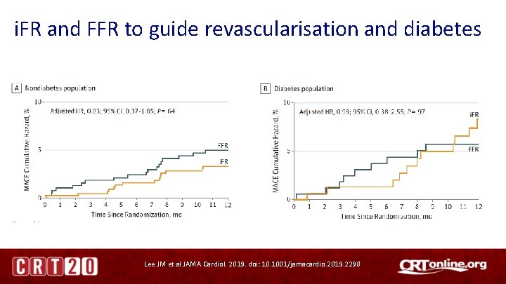 i. FR and FFR to guide revascularisation and diabetes Lee JM et al JAMA