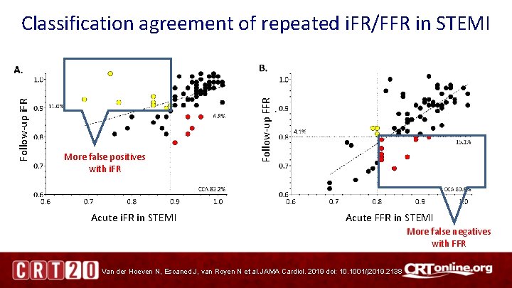 More false positives with i. FR Acute i. FR in STEMI Follow-up FFR Follow-up