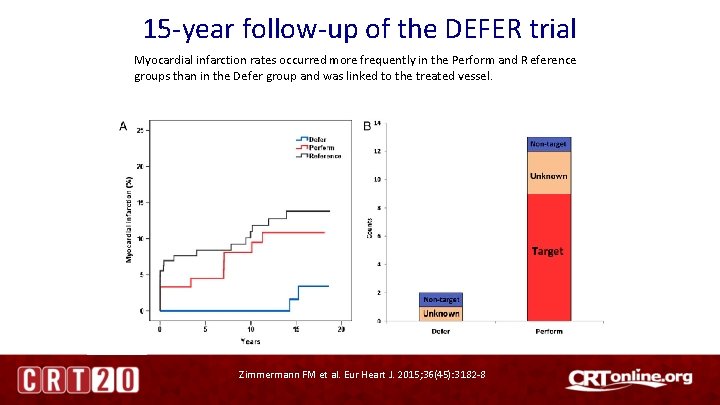 15 -year follow-up of the DEFER trial Myocardial infarction rates occurred more frequently in