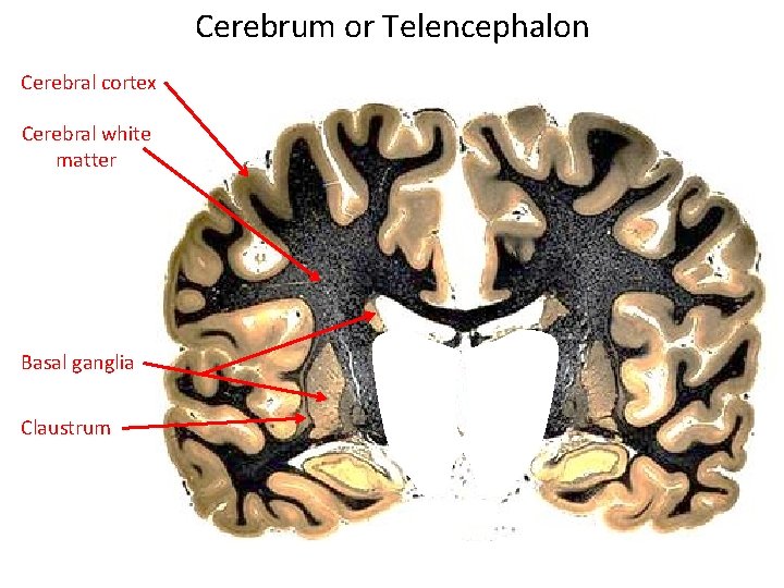 Cerebrum or Telencephalon Cerebral cortex Cerebral white matter Basal ganglia Claustrum 