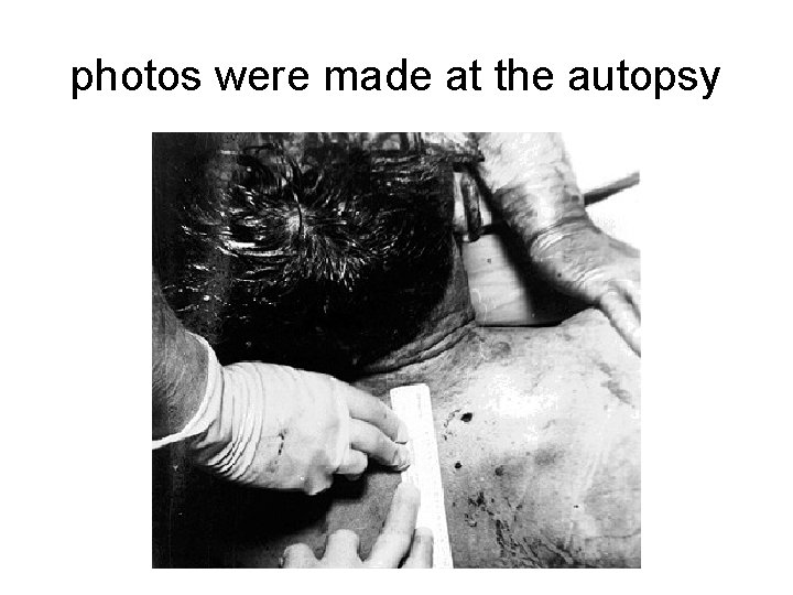 photos were made at the autopsy 