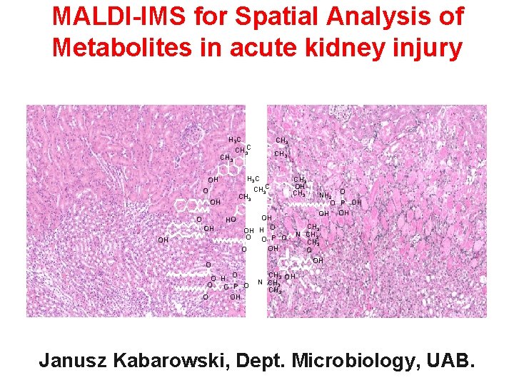 MALDI-IMS for Spatial Analysis of Metabolites in acute kidney injury H 3 C CH