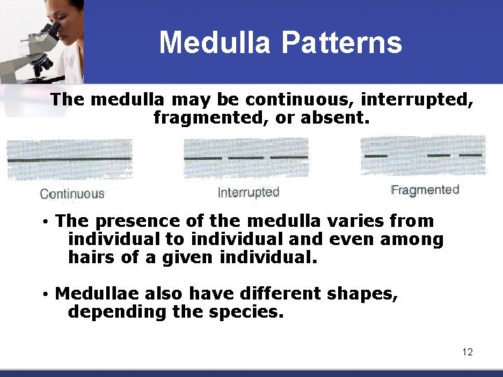 Medulla Patterns The medulla may be continuous, interrupted, fragmented, or absent. • The presence