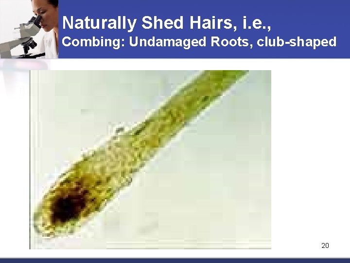 Naturally Shed Hairs, i. e. , Combing: Undamaged Roots, club-shaped 20 