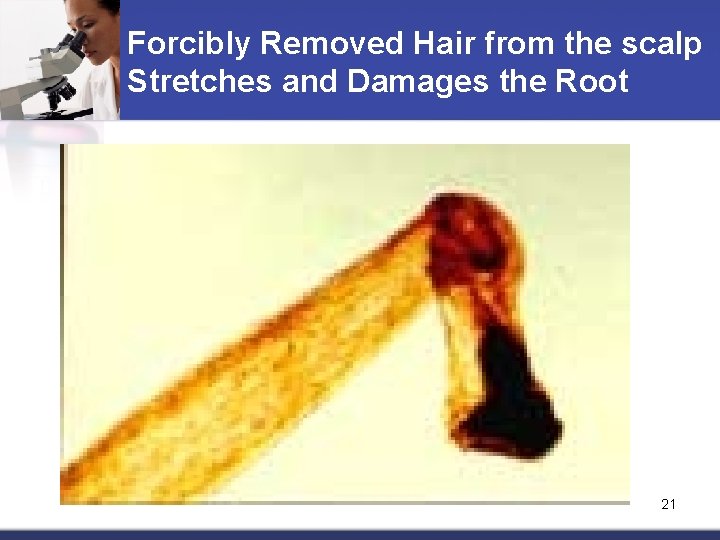 Forcibly Removed Hair from the scalp Stretches and Damages the Root 21 