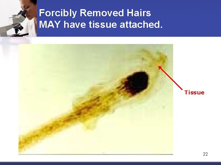 Forcibly Removed Hairs MAY have tissue attached. Tissue 22 