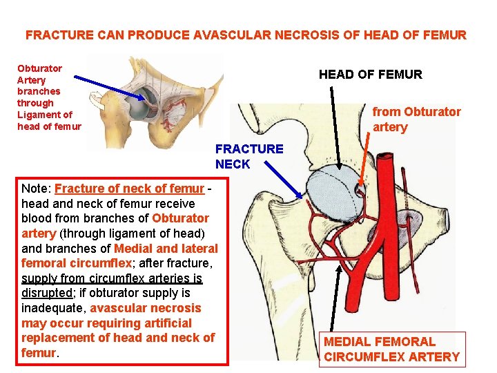 FRACTURE CAN PRODUCE AVASCULAR NECROSIS OF HEAD OF FEMUR Obturator Artery branches through Ligament