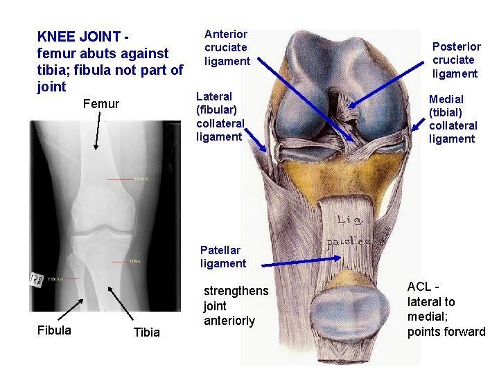 KNEE JOINT femur abuts against tibia; fibula not part of joint Femur Anterior cruciate
