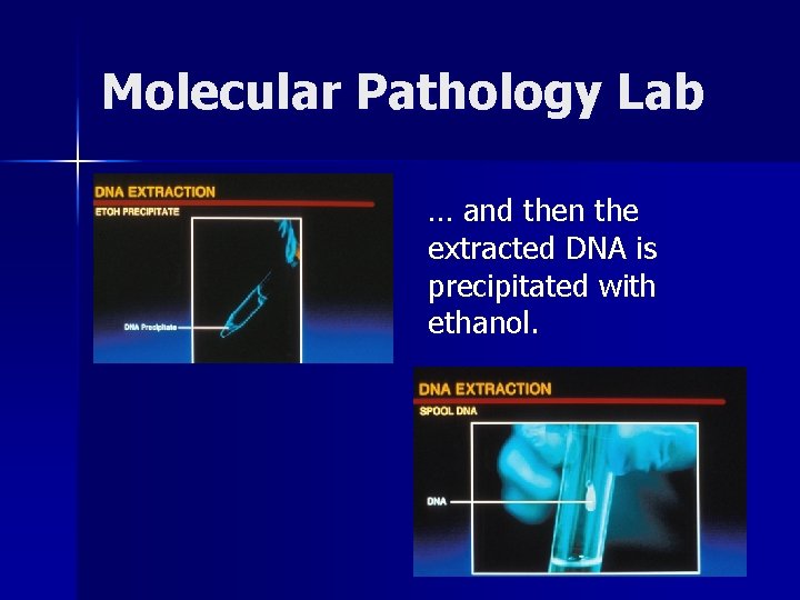 Molecular Pathology Lab … and then the extracted DNA is precipitated with ethanol. Molecular Pathology Lab … and then the extracted DNA is precipitated with ethanol.