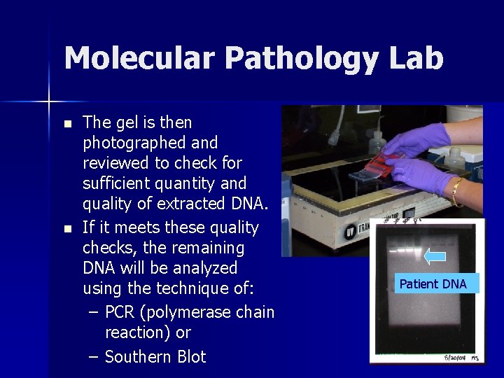 Molecular Pathology Lab n n The gel is then photographed and reviewed to check Molecular Pathology Lab n n The gel is then photographed and reviewed to check