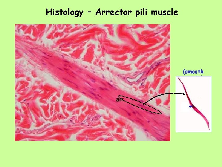 Histology – Arrector pili muscle (smooth muscle) 