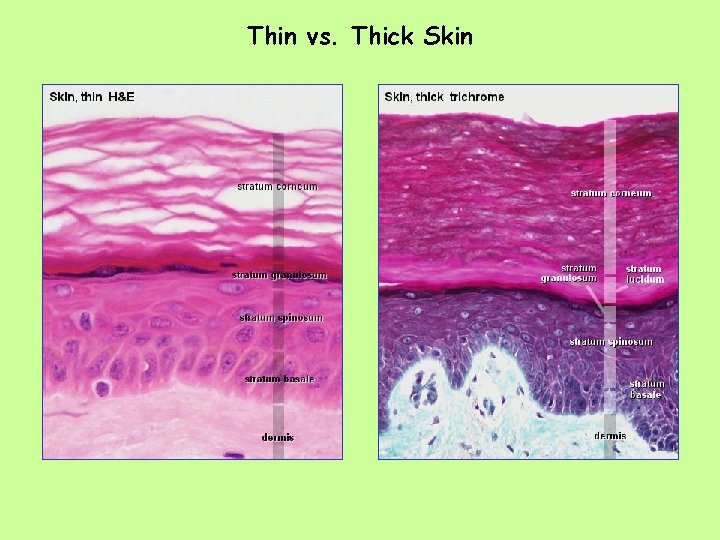 Thin vs. Thick Skin 